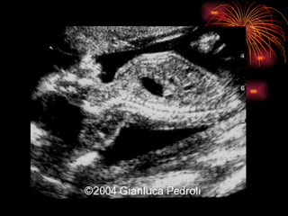 CONGENITAL MALFORMATIONS gogo.ppt cfmf   n