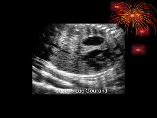 CONGENITAL MALFORMATIONS gogo.ppt cfmf   n