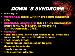 DOWN ´S SYNDROME
• Trisomy 21.
• Incidence: rises with increasing maternal
age.
• Antenatal diagnosis: U/S ( thick nuchal fold,
short femur), MSAFP, karyotyping
(amniocentesis, CVS).
• Features:
 Head: flat face, inner epicanthal folds, small flat
nose, small mouth, protruding tongue.
 Neck: short, broad.
 Hands: simian crease, short fingers.
 Muscles: hypotonia.
 Heart: anomalies.
 GIT: duodenal atresia.
 