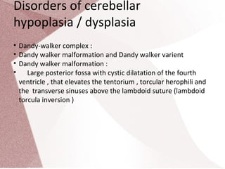 Torcular Inversion Congenital malformations of brain | PPT