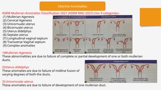 Congenital malformations of female genital organs.pptx
