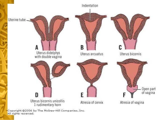 Female With Two Vaginas 35