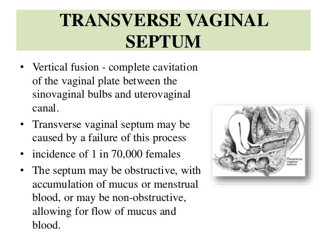 Congenital malformations of genital organs