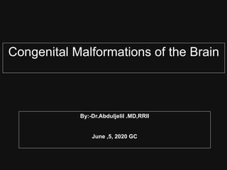 Congenital Malformations of the Brain
By:-Dr.Abduljelil .MD,RRII
June ,5, 2020 GC
 