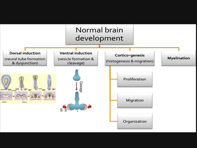 Congenital malformations of the brain abdul final | PDF