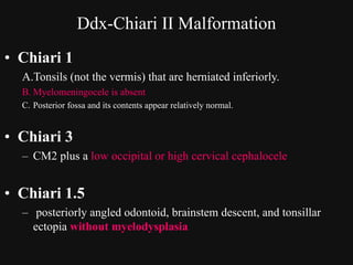 Congenital malformations of the brain abdul final | PDF