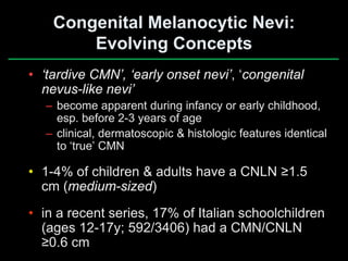 Congenital melanocytic nevi when to worry & when to treat | PDF
