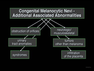 Congenital melanocytic nevi when to worry & when to treat | PDF