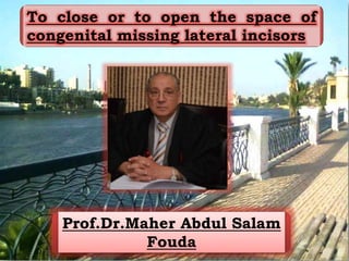 To close or to open the space of
congenital missing lateral incisors
Prof.Dr.Maher Abdul Salam
Fouda
 