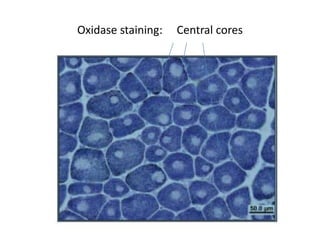 Oxidase staining: Central cores
 