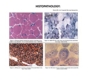 HISTOPATHOLOGY:
 