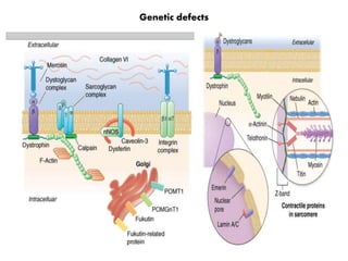 Genetic defects
 