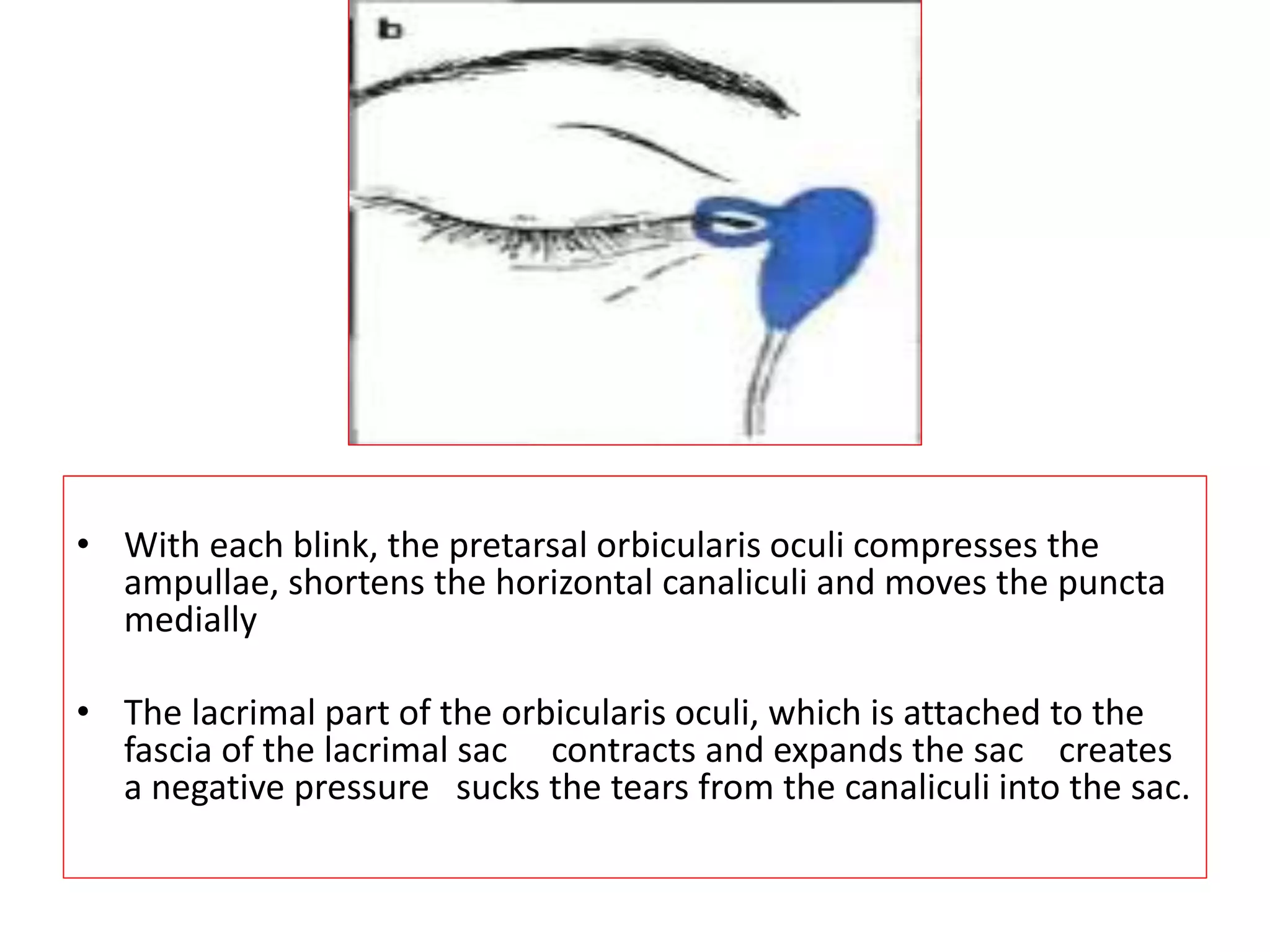 Congenital nasolacrimal duct obstruction | PPTX