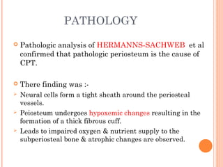 PATHOLOGY
 Pathologic analysis of HERMANNS-SACHWEB et al
confirmed that pathologic periosteum is the cause of
CPT.
 There finding was :-
 Neural cells form a tight sheath around the periosteal
vessels.
 Peiosteum undergoes hypoxemic changes resulting in the
formation of a thick fibrous cuff.
 Leads to impaired oxygen & nutrient supply to the
subperiosteal bone & atrophic changes are observed.
 