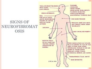 SIGNS OF
NEUROFIBROMAT
OSIS
 