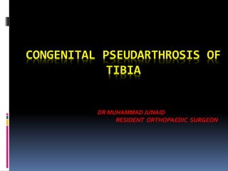 CONGENITAL PSEUDARTHROSIS OF
TIBIA
DR MUHAMMAD JUNAID
RESIDENT ORTHOPAEDIC SURGEON
 