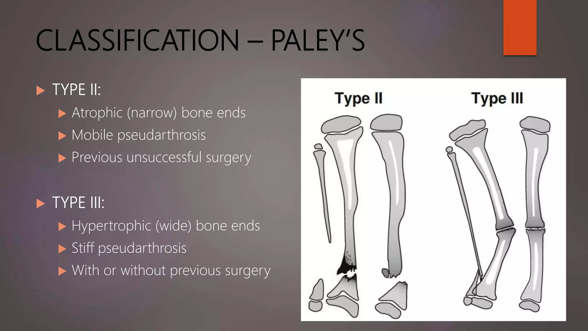 CLASSIFICATION – PALEY’S
 TYPE II:
 Atrophic (narrow) bone ends
 Mobile pseudarthrosis
 Previous unsuccessful surgery
 TYPE III:
 Hypertrophic (wide) bone ends
 Stiff pseudarthrosis
 With or without previous surgery
 
