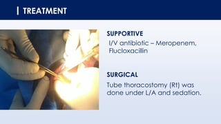 TREATMENT
SUPPORTIVE
I/V antibiotic – Meropenem,
Flucloxacillin
SURGICAL
Tube thoracostomy (Rt) was
done under L/A and sedation.
 