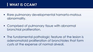 WHAT IS CCAM?
▪ Rare pulmonary developmental hamarto-matous
abnormality.
▪ Comprised of pulmonary tissue with abnormal
bronchial proliferation.
▪ The fundamental pathologic feature of the lesion is
adenomatoid proliferation of bronchioles that form
cysts at the expense of normal alveoli.
 