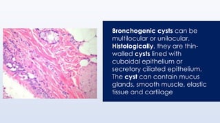 Bronchogenic cysts can be
multilocular or unilocular.
Histologically, they are thin-
walled cysts lined with
cuboidal epithelium or
secretory ciliated epithelium.
The cyst can contain mucus
glands, smooth muscle, elastic
tissue and cartilage
 