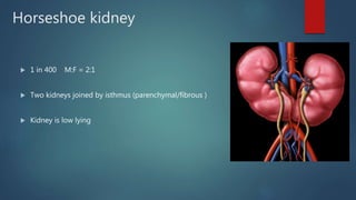 Congenital renal anomalies | PPTX