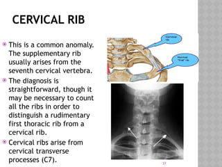 congenital skeletal anomaly.presentation | PPTX