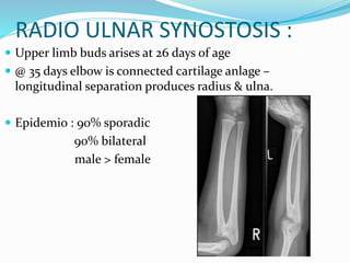 RADIO ULNAR SYNOSTOSIS :
 Upper limb buds arises at 26 days of age
 @ 35 days elbow is connected cartilage anlage –
longitudinal separation produces radius & ulna.
 Epidemio : 90% sporadic
90% bilateral
male > female
 