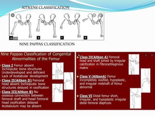 AITKENS CLASSIFICATION
NINE PAPPAS CLASSIFICATION
 