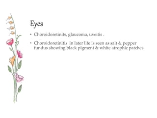 Eyes
• Choroidoretinits, glaucoma, uveitis .
• Choroidoretinitis in later life is seen as salt & pepper
fundus showing black pigment & white atrophic patches.
 