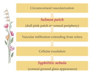 Circumcorneal vascularization
Salmon patch
(dull pink patch at corneal periphery)
Vascular infiltration extending from sclera
Cellular exudation
Syphilitic nebula
(corneal ground glass appearance)
 