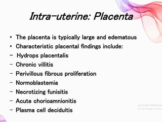 Congenital syphillis ppt use in OBG And MSN | PPTX