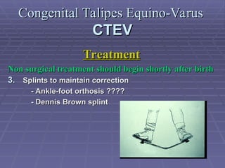 Congenital Talipes Equino-Varus.ppt Congenital Talipes Equino-Varus.ppt