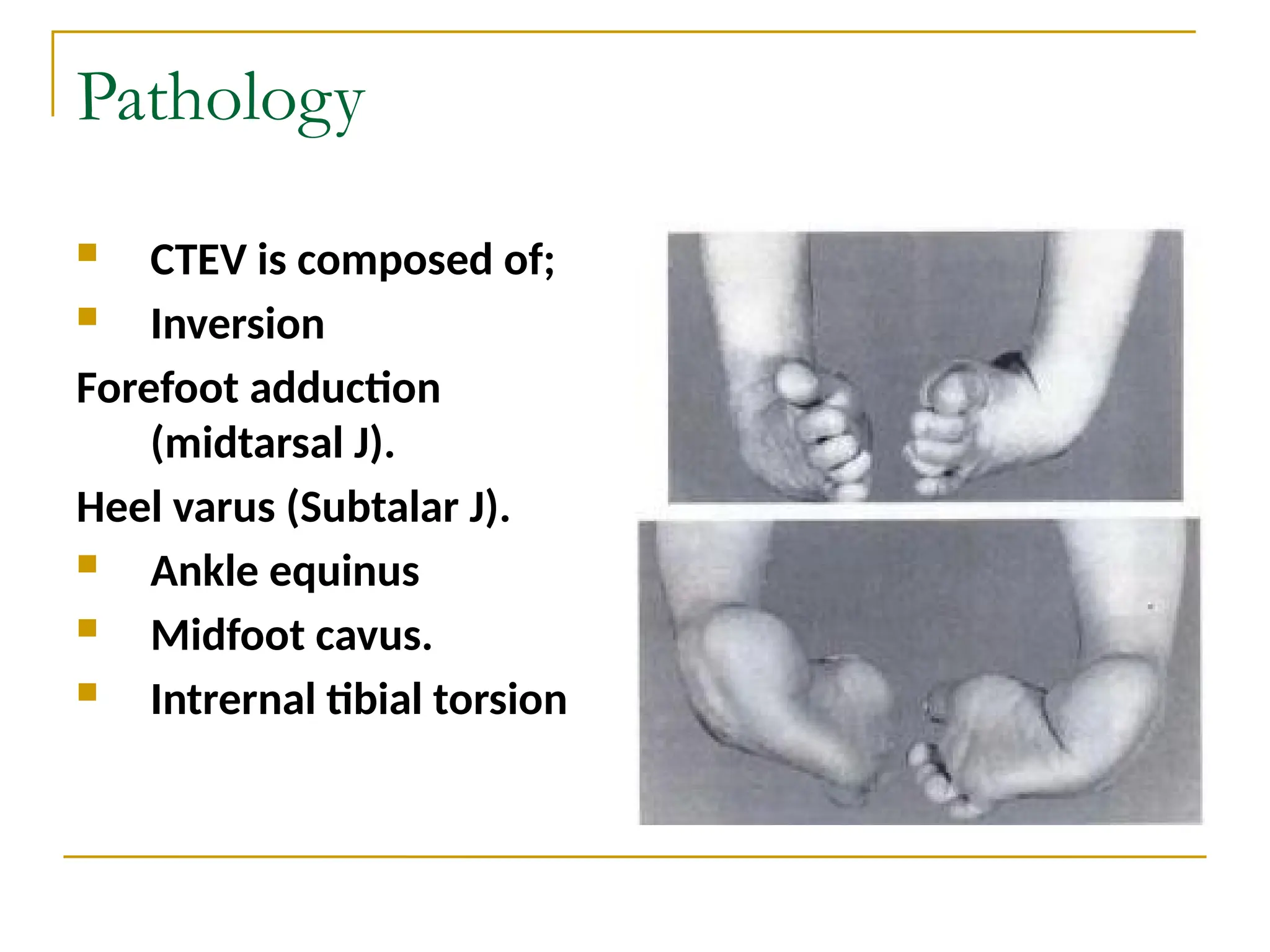 The Latest Advances In Equino Varus Treatment: Are They Right For You? - xl89x4a