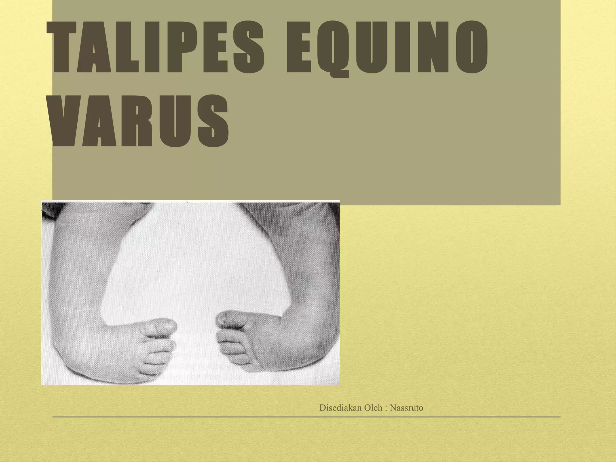 Equino Varus: Preventing Long Term Complications - 2jcp0u2