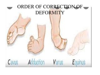 Congenital talipes equinus varus (CTEV).pptx