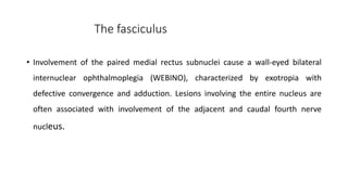 The fasciculus
• Involvement of the paired medial rectus subnuclei cause a wall-eyed bilateral
internuclear ophthalmoplegia (WEBINO), characterized by exotropia with
defective convergence and adduction. Lesions involving the entire nucleus are
often associated with involvement of the adjacent and caudal fourth nerve
nucleus.
 
