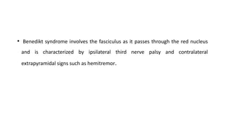 • Benedikt syndrome involves the fasciculus as it passes through the red nucleus
and is characterized by ipsilateral third nerve palsy and contralateral
extrapyramidal signs such as hemitremor.
 