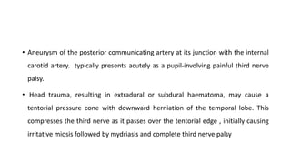 • Aneurysm of the posterior communicating artery at its junction with the internal
carotid artery. typically presents acutely as a pupil-involving painful third nerve
palsy.
• Head trauma, resulting in extradural or subdural haematoma, may cause a
tentorial pressure cone with downward herniation of the temporal lobe. This
compresses the third nerve as it passes over the tentorial edge , initially causing
irritative miosis followed by mydriasis and complete third nerve palsy
 