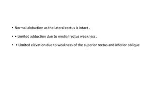 • Normal abduction as the lateral rectus is intact .
• • Limited adduction due to medial rectus weakness .
• • Limited elevation due to weakness of the superior rectus and inferior oblique
 