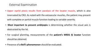 External Examination
• Upper eyelid ptosis results from paralysis of the levator muscle, which is also
innervated by CN3. As noted with the extraocular muscles, the patient may present
with complete or partial muscle function leading to variable severity.
• Most important to prevent amblyopia is determining whether the visual axis is
obstructed by the lid.
• For surgical planning, measurements of the patient’s MRD1 & levator function
should be obtained.
• Presence of a Bell’s phenomenon should be evaluated.
 
