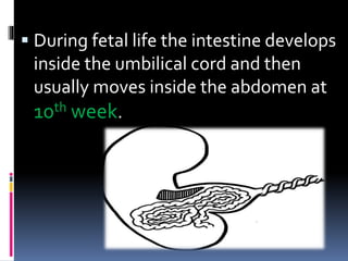 Umbilical Inverted Congenital umblical hernia | PPTX