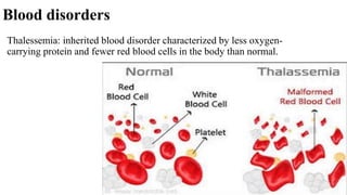 Blood disorders
Thalessemia: inherited blood disorder characterized by less oxygen-
carrying protein and fewer red blood cells in the body than normal.
 