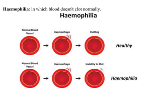 Haemophilia: in which blood doesn't clot normally.
 