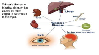 Wilson’s disease: an
inherited disorder that
causes too much
copper to accumulate
in the organ.
 