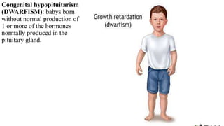 Congenital hypopituitarism
(DWARFISM): babys born
without normal production of
1 or more of the hormones
normally produced in the
pituitary gland.
 