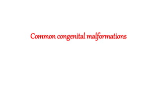 Common congenital malformations
 