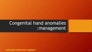 Congenital hand anomalies
:management
Dr.Khaldon abdulrhamn alaghbari ZoReKh
 
