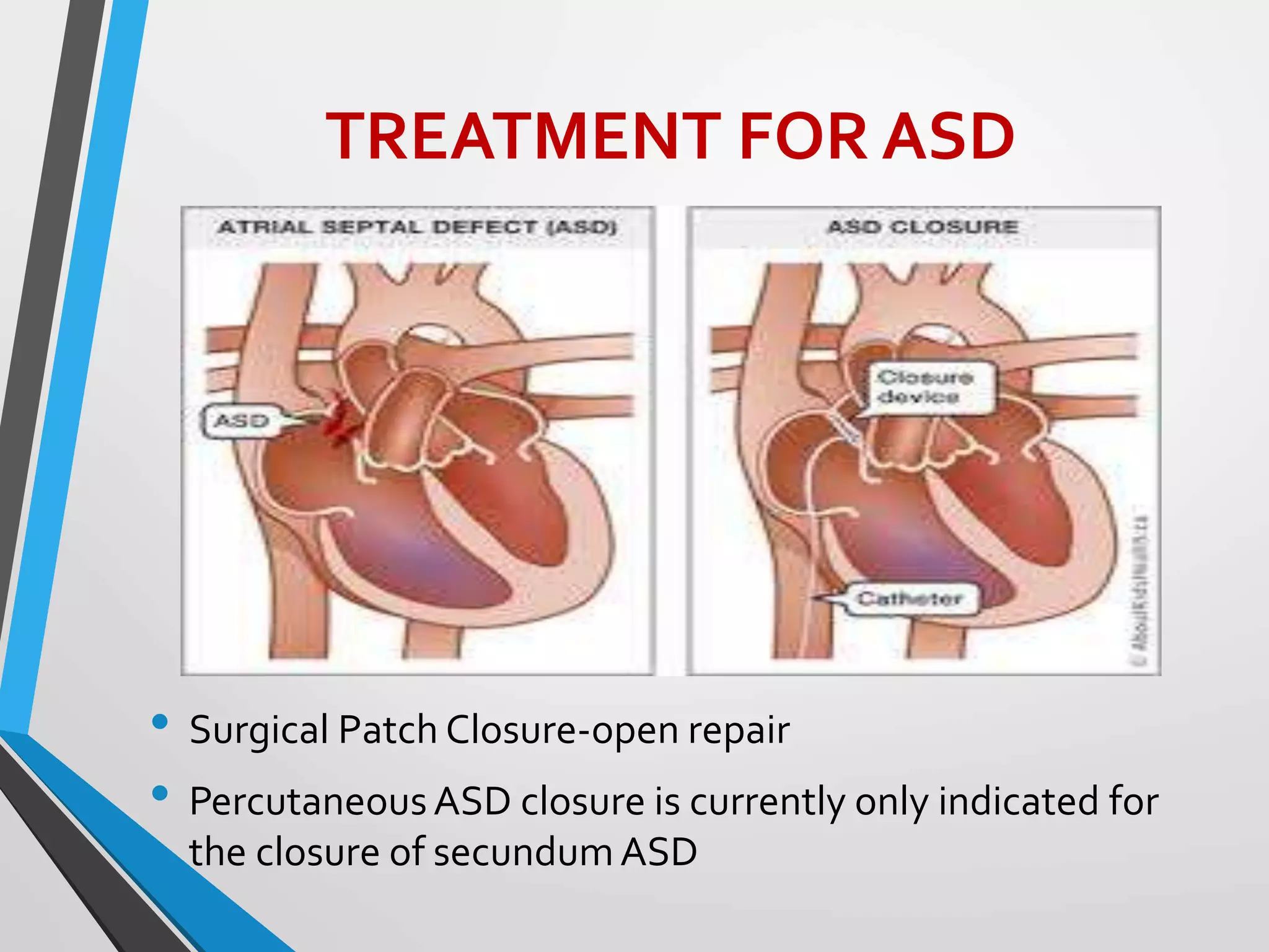 CONGENITAL HEART DISEASES PPT | PPTX