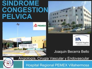 SINDROME
CONGESTION
PELVICA
Joaquin Becerra Bello
Angiología, Cirugia Vascular y Endovascular
Hospital Regional PEMEX Villahermosa
 