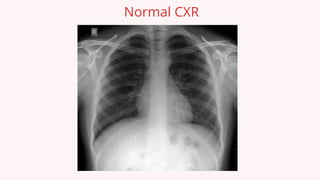 Comprehensive Overview of Congestive Heart Failure: Definitions ...